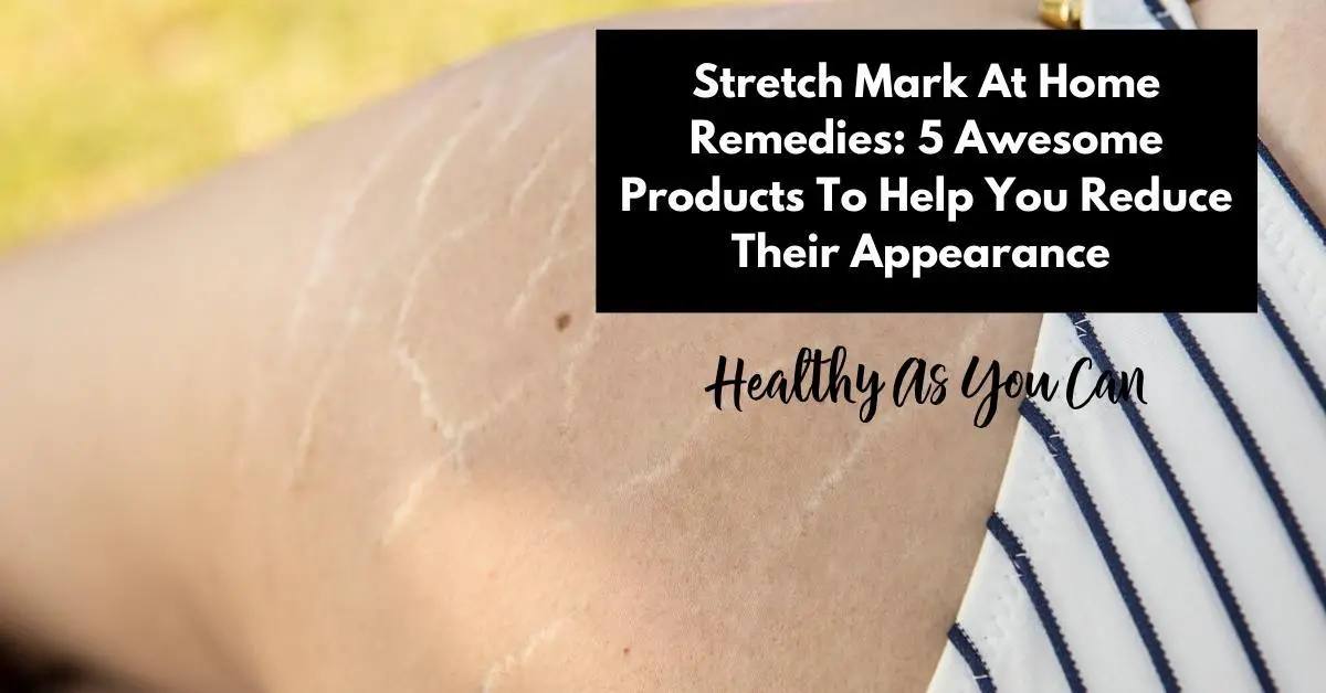 Stretch Mark At Home Remedies: 5 Awesome Products To Help You Reduce